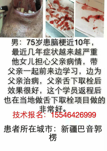 新疆案例分享