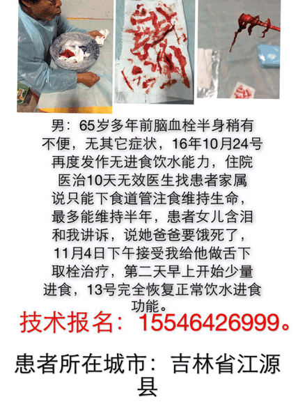江源案例分享